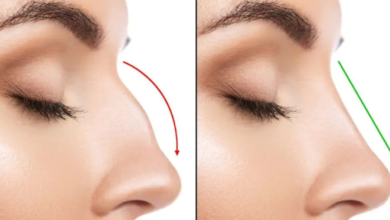 عمليات تجميل الأنف… مع دكتور التجميل “Ali Abedali”