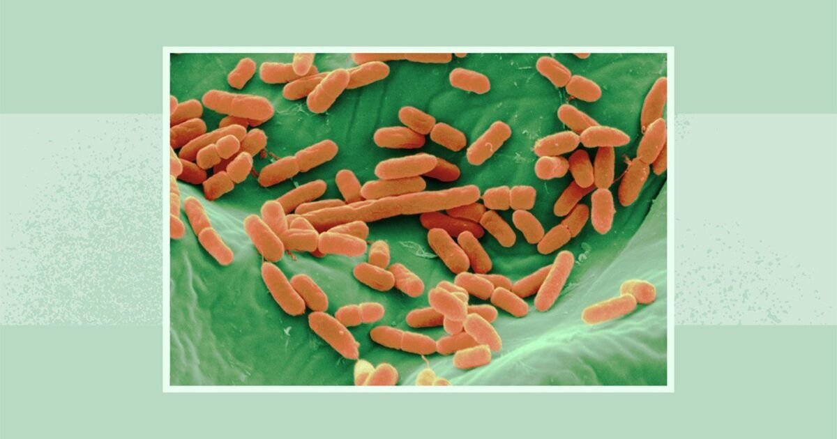 سحب براعم الفجل Robust Radish Mix (5 أونصات) بسبب احتمال E. coli والسالمونيلا