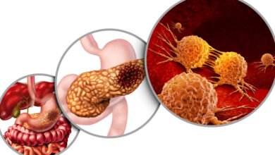 Revolution Medicines تحصل على موافقة أميركية لعلاج سرطان البنكرياس