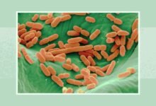 سحب براعم الفجل Robust Radish Mix (5 أونصات) بسبب احتمال E. coli والسالمونيلا