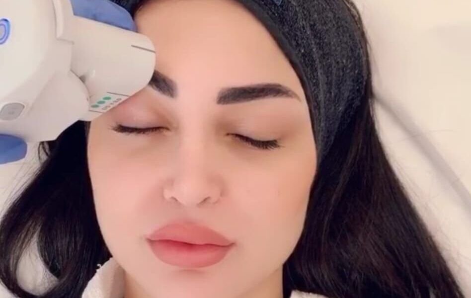 تعرفي على تقنية Ultherapy مع الدكتور رامي عبادي