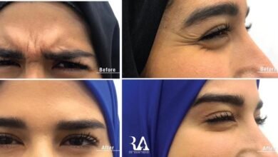 حوار مع دكتور الأمراض الجلديَّة والتّجميل رامي عبادي